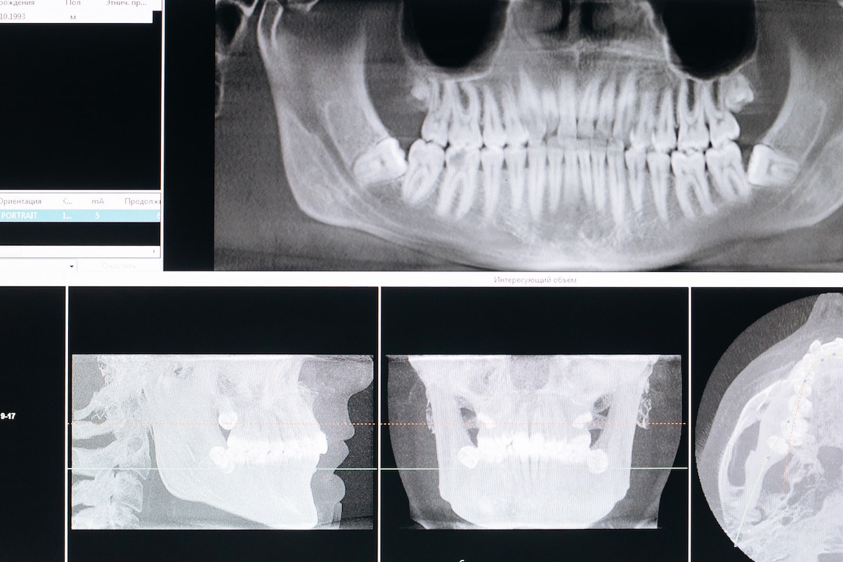 Dentisti con Radiologia al Centro Dentale Parmense Parma e Provincia: Agevolazioni Costi bassi e Materiali di Alta Qualità